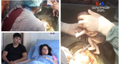 Թե ինչպես Երևանում հնգյակ ծնվեց. նկարահանումն արվել է հենց ծննդաբերության ժամանակ.Տեսանյութ